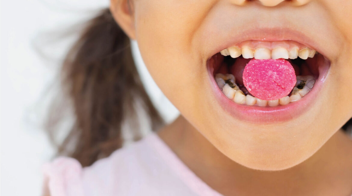 Close-up of a child's open mouth with a bright pink candy on their tongue, revealing visible signs of tooth decay on the molars, which illustrates the impact of dietary habits on dental health beyond just sugar.