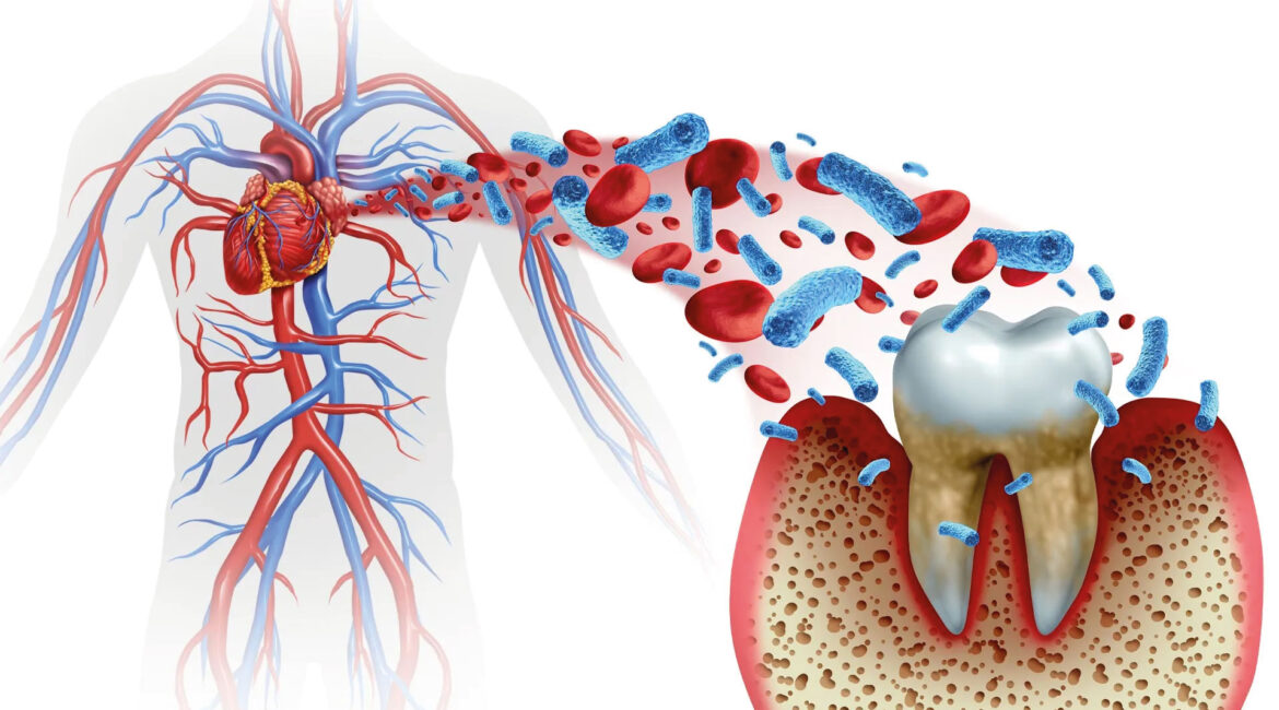A detailed medical illustration depicting oral bacteria and red blood cells moving from a diseased tooth and gum area towards the human cardiovascular system, symbolizing the profound link between oral health and systemic well-being.