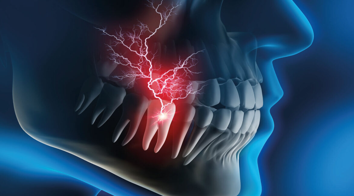 Graphic representation of a healthy toothache radiating into the jaw. The image illustrates the concept of our meta title "Healthy Toothache? Discover the True Causes at Dr. Lenia's," emphasizing how a pain perceived in a tooth can originate from surrounding nerves or other non-dental conditions.